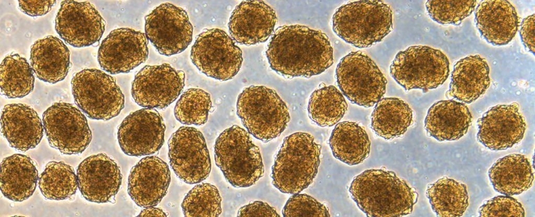 Human insulin-secreting beta cells under the microscope. (Millman Laboratory)