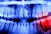 Stručnjak otkriva iznenađujuću vezu između oralnog zdravlja i vašeg mozga