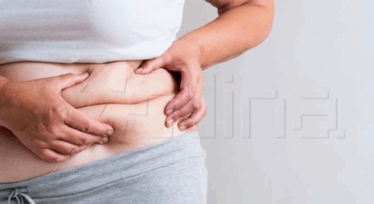 Gubitak težine nije dovoljan za borbu protiv dijabetesa