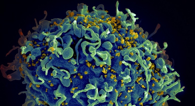 Znanstvenici metodom Crispr uspjeli eliminirati HIV iz stanica