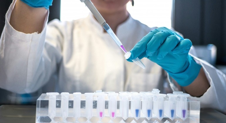 Test krvi mogao bi identificirati milijune ljudi koji nesvjesno šire tuberkulozu
