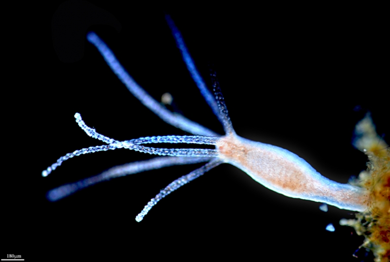 Hydra vulgaris. Izvor: biobus.ca