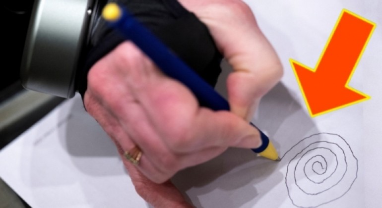 Nevjerojatna rukavica mijenja život oboljelima od Parkinsonove bolesti